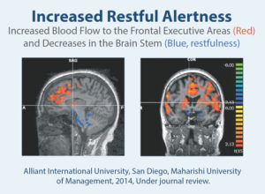 Transcendental Meditation: Deactivation of the Amygdala, Reactivation of the Pre-Frontal Cortex